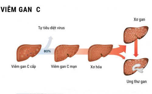 Viêm gan C – Căn bệnh truyền nhiễm nguy hiểm