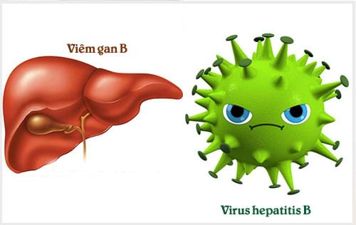 Bệnh viêm gan b có chữa được không? Căn nguyên của căn bệnh viêm gan B